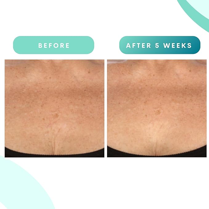 Serious Skincare - Glycolic Firming Retexturizing Body Cream - Moisturizing - Hydrating for Dry Skin - BODY FIT™ - For Crepey and Sagging Skin - Gentle Exfoliation for Smoother Skin - 8 Fl. Oz.