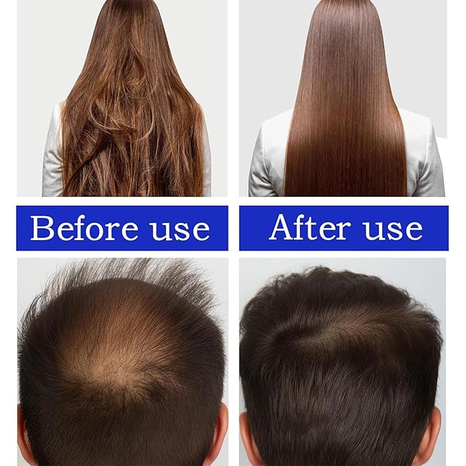 100% & Unrefined Pure Batana Miracle Oil for Smoother Hair Growth - from Honduras, Repairs Damaged Hair & Hair Loss, 2 oz
