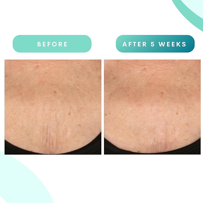 Serious Skincare - Glycolic Firming Retexturizing Body Cream - Moisturizing - Hydrating for Dry Skin - BODY FIT™ - For Crepey and Sagging Skin - Gentle Exfoliation for Smoother Skin - 8 Fl. Oz.