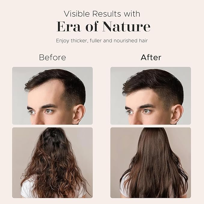 era of nature Hard Batana Oil Raw & Unrefined – 100% Batana Oil from Honduras for Hair & Scalp – Nourishes, Strengthens, and Supports Healthy Hair – Pure Organic – 4.16 oz