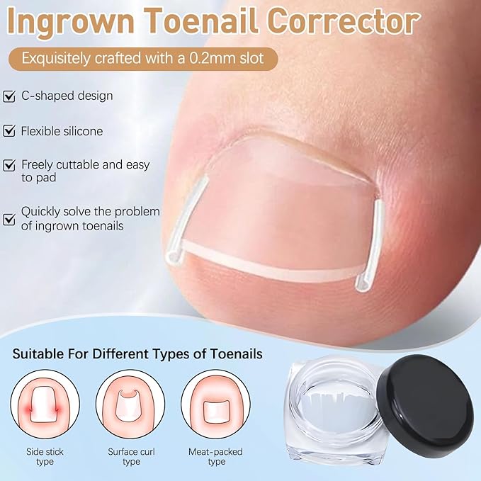 Ingrown Toenail Corrector Set with Correction Strips,Professional Ingrown Toenails Pedicure Tool Set, Toenail Correction Strips & Ingrown Toenail Corrector,Ingrown Nail Tool for Women Man
