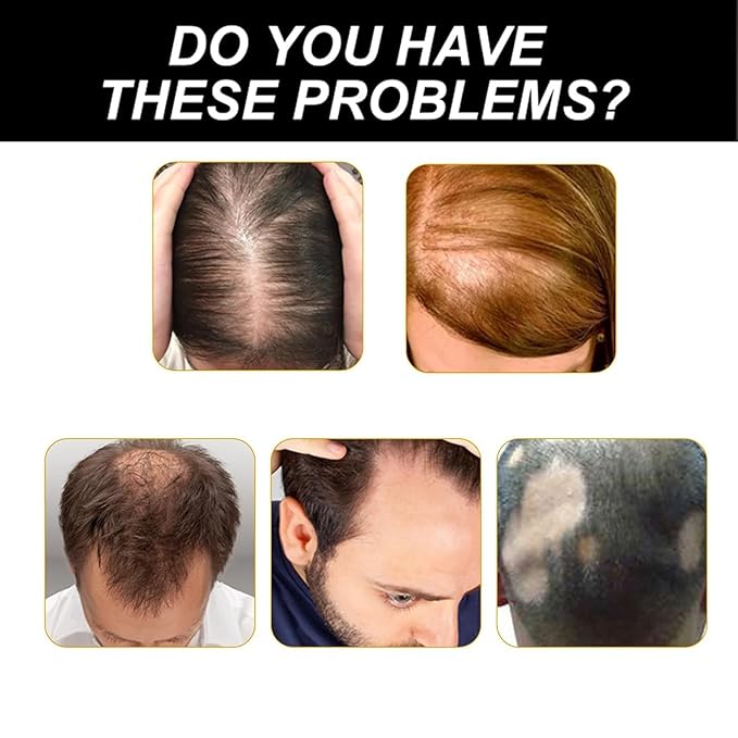 Nordic Biolabs Stem Cell Complete Hair Growth Cycle Solution 2.0,NordicBiolabs Stem Cells & Multi-peptides Serum Ampoules,Deeply repair thicken the hair (1PCS)
