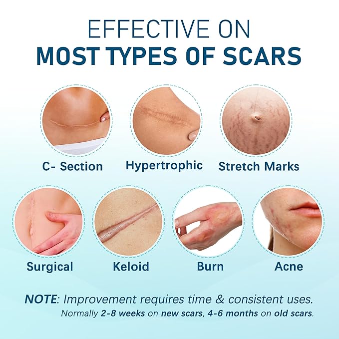 Silicone Scar Sheets, Large 10Pcs 4” x 7” Each, Medical Silicone Tape for Scar Treatment, Scar Patches for C-Section, Keloid Bump, Stretch Marks, Burn, Acne, Surgical Scar Removal