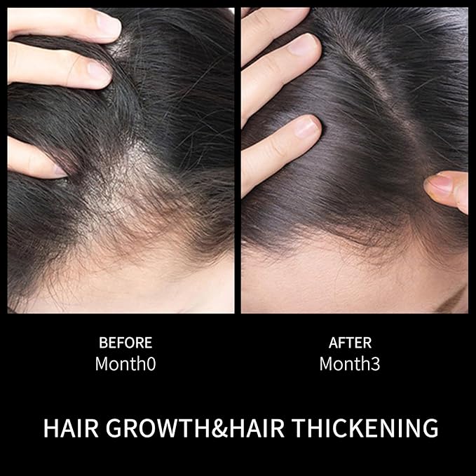 Ceson&Cesun Hair Growth Serum/Scalp Oil - Biotin & Rosemary Castor Oil Treatment for Stronger Thicker Longer Hair, Water-Based – Natural Hair Growth Thickening Treatment for Men & Women