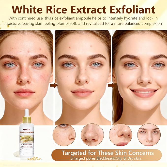 Peel Shot Glow White Rice Peeling Ampoule, Rice Extract Exfoliating Serum Dead Skin Care for Face and Body Scrub, Gentle Skincare, Pore Refiner & Deep Hydration for All Skin Types（80ML/2.71 Fl Oz）
