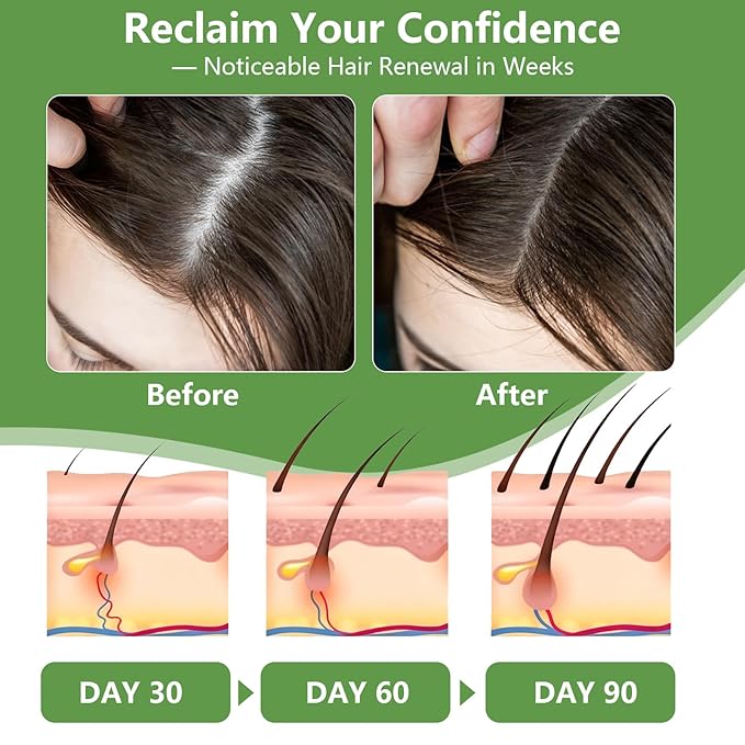 Batana Oil for Hair Growth – 100% Pure Raw Organic Hair Oil from Nature –Deep Repair Hair Treatment for Men and Women to Prevent Hair Loss & Enhance Thickness (4.2oz)