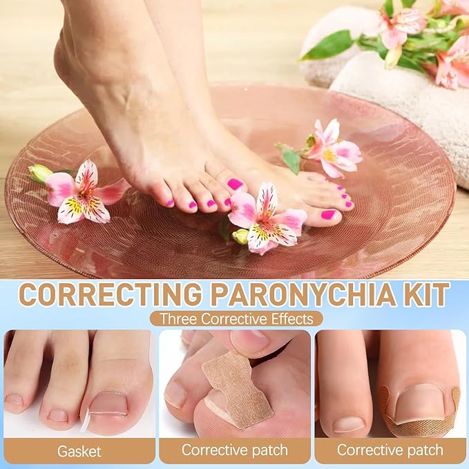Ingrown Toenail Corrector Set with Correction Strips,Professional Ingrown Toenails Pedicure Tool Set, Toenail Correction Strips & Ingrown Toenail Corrector,Ingrown Nail Tool for Women Man