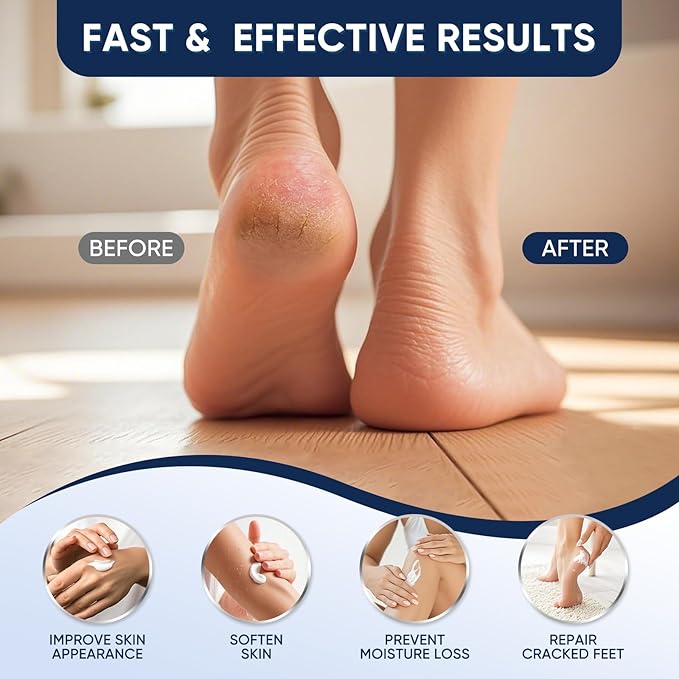 Urea Cream 60 Percent for Feet Maximum Strength, Urea Cream 60% Plus Salicylic Acid 2%, Foot & Hand Cream for Dry Cracked