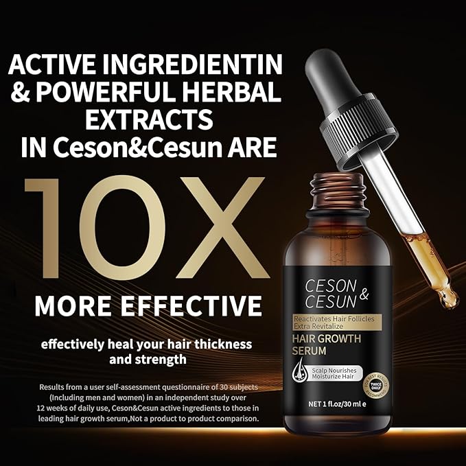 Ceson&Cesun Hair Growth Serum/Scalp Oil - Biotin & Rosemary Castor Oil Treatment for Stronger Thicker Longer Hair, Water-Based – Natural Hair Growth Thickening Treatment for Men & Women