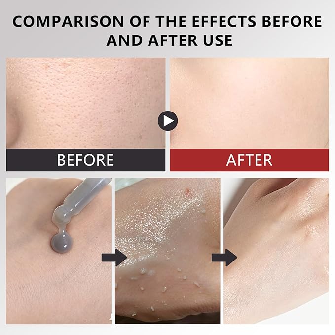 Black Rice Exfoliating Glow Ampoule – Rice Peel Shot for Deep Hydration & Exfoliation, Radiant Glow for Face and Body, 80ml