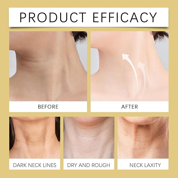 AH-8 Neck and Eye Cream Set with Electric Massage Tightening, Anti-Wrinkle Treatment with Red Light, Deep Moisturizer Bundle Care (Neck Cream)