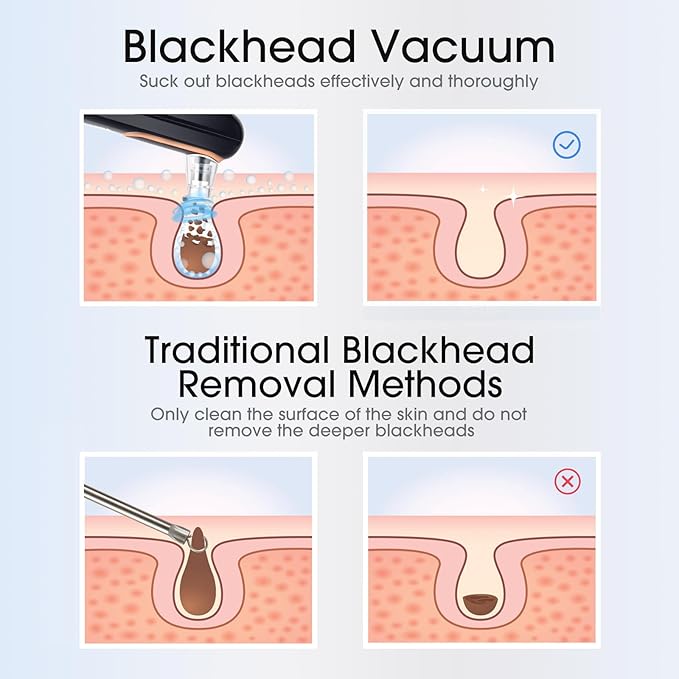 Yccu Blackhead Remover Vacuum Pore Extractor Black Head Remover for Face and Nose Blackhead Extractor Tool Pore Cleane Vacuum with USB Charge 4 Modes 5 Suction Heads for Women and Men (Black)