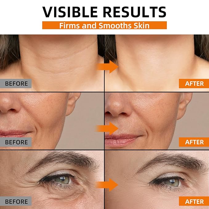 Super 22% Vitamin C Retinol Serum for Face: Advance Anti-Aging & Brightening Formula with Hyaluronic Acid, Niacinamide, Collagen, Peptides - Hydrates, Smooths, Targets Age Spots, Wrinkles, 1.7 Fl Oz