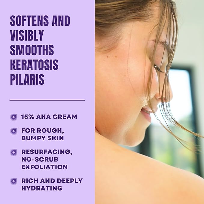 AmLactin KP Bumps Be Gone - Therapeutic Body Cream for Keratosis Pilaris - No-Scrub Exfoliator and Moisturizer with 15% Lactic Acid AHA, 3 oz, Pack of 2 (Packaging May Vary)