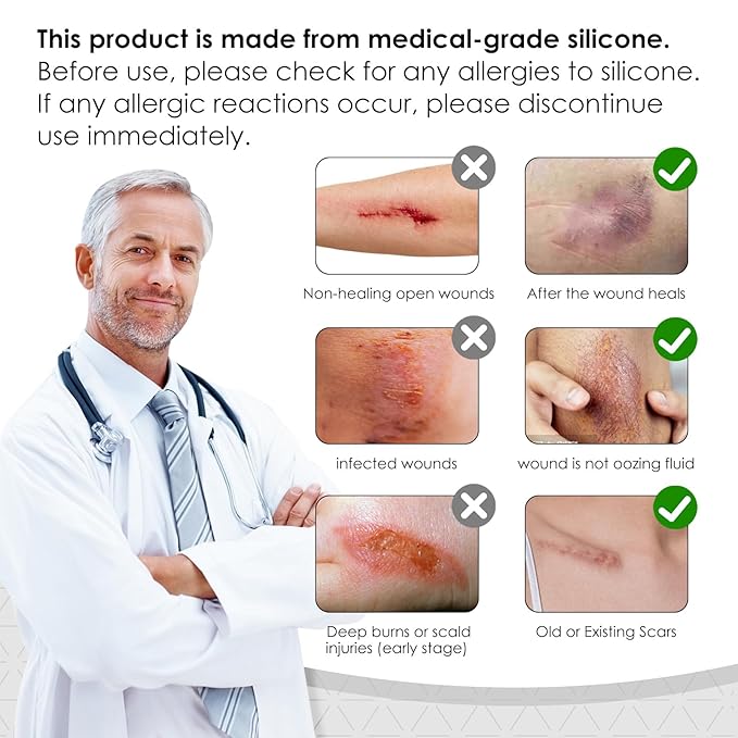 Silicone Scar Sheets,Silicone Scar Tape for Removal Treatment,Medical Grade Scar Tape for Surgical Scars,C-Section,Tummy Tuck,Scar Removal Away(1.6" x 60" Roll - 1.5M) Keloid Bump Removal