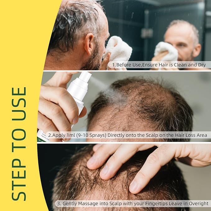 Hair Growth Oil Spray Batana Oil Dr Sebi Organic With Rosemary Castor Ginger, Natural Hair Loss Treatments for Women Men Promotes Regrowth Reduces Loss Thinning Strengthen Scalp Nourishes Dry