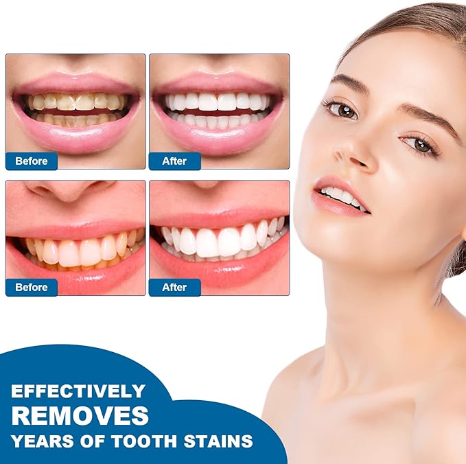 Teeth Whitening Essence Pen for Cleaning Teeth Stains, Freshening Breath and Reducing Yellowing (3pcs)