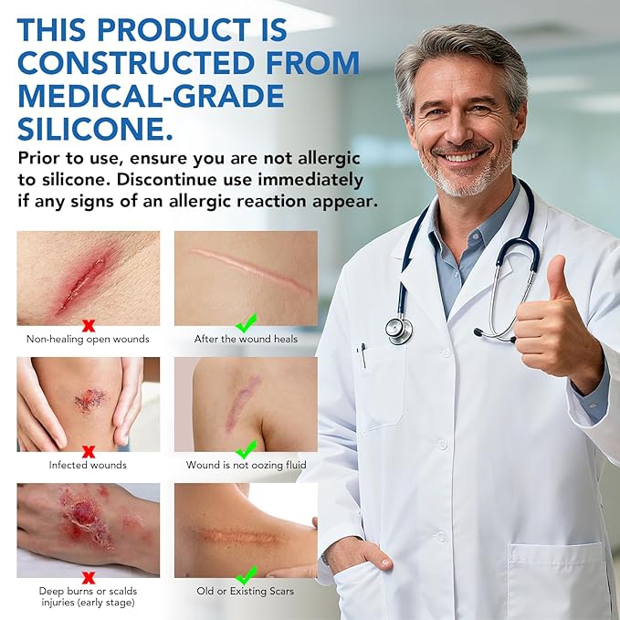 Silicone Scar Sheets, Silicone Scar Tape(1.6"x 200" Roll-5M) - Reusable, Soft & Medical Grade Adhesive Tape for Old & New Scars, C-Section, Surgery, Keloid & Acne Scars