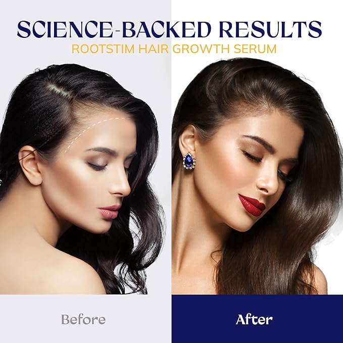 Hair Growth Spray, Rice Water & Biotin & Caffeine, Hair Growth Serum for Men & Women, Hair Oils for Hair Growth -Longer, Fuller Hair, Enriched with Seven Herbal Extracts 2.03 Fl Oz (Pack of 1)