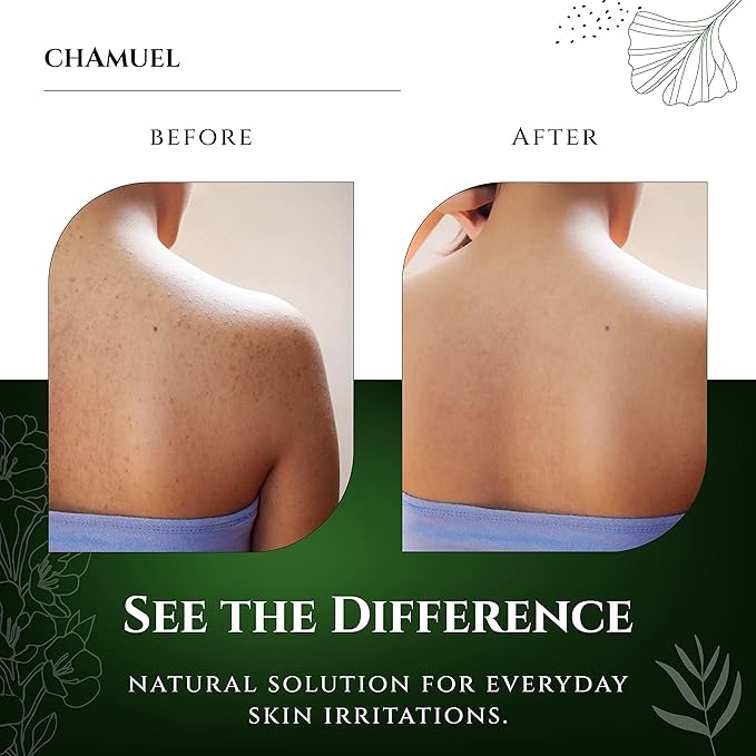 Chamuel Tea Tree Balm & Body Wash - The Best Product Combo to Soothe a Wide Variety of Skin Irritations