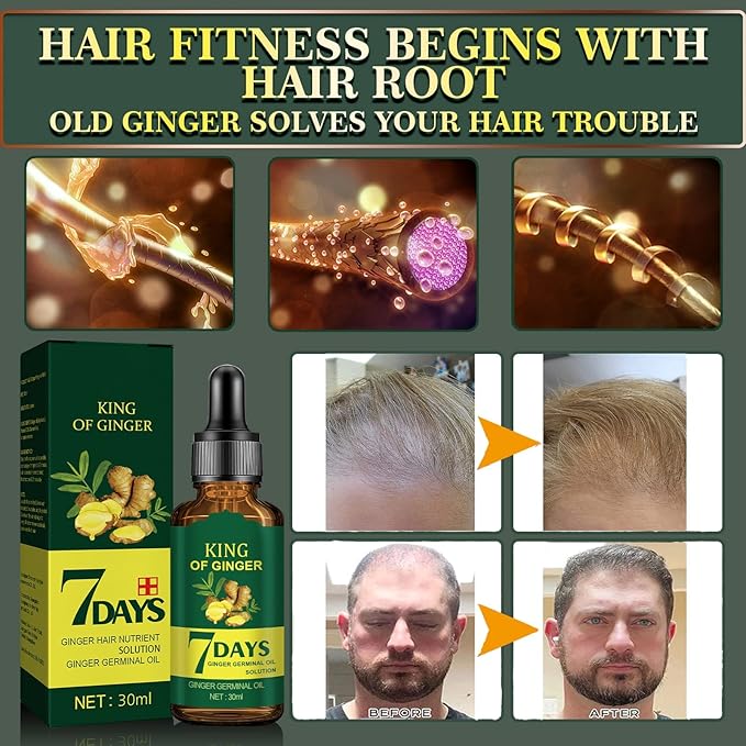 Biotin Hair Growth Serum for Hair Loss Treatment and Regrowth - Natural Ginger Essential Oil for Stronger, Thicker and Longer Hair for Women & Men (1.0 Fl Oz / 30ML)