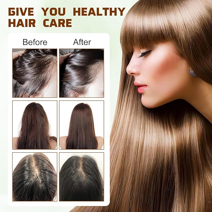 100% Natural Raw Batana Oil for Hair Growth,Dr Sebi Hair Growth Oil From Honduras,Unrefined Hair Oil,Natural and Pure,Prevents Hair Loss and Promotes Hair Thickness for Men and Women（2 Bottles）
