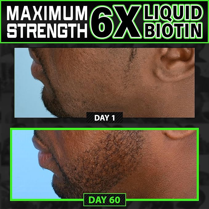 Beard Growth Kit w/ 2X Thickening Biotin Beard Balm/Beard Care & Beard Conditioner + 6X Liquid Biotin with Collagen Peptides for Beard & Hair Growth