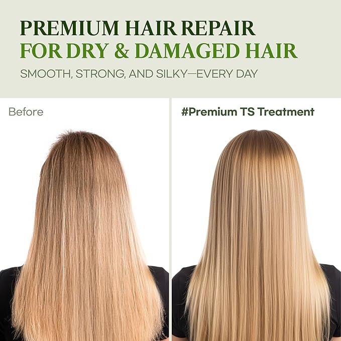 TS Premium TS Treatment | Korean Hair Care with Argan Oil & Shea Butter | Repairs Damaged, Weak Hair | Soothes Scalp Discomfort with Natural Plant Extracts (16.9 Fl Oz)