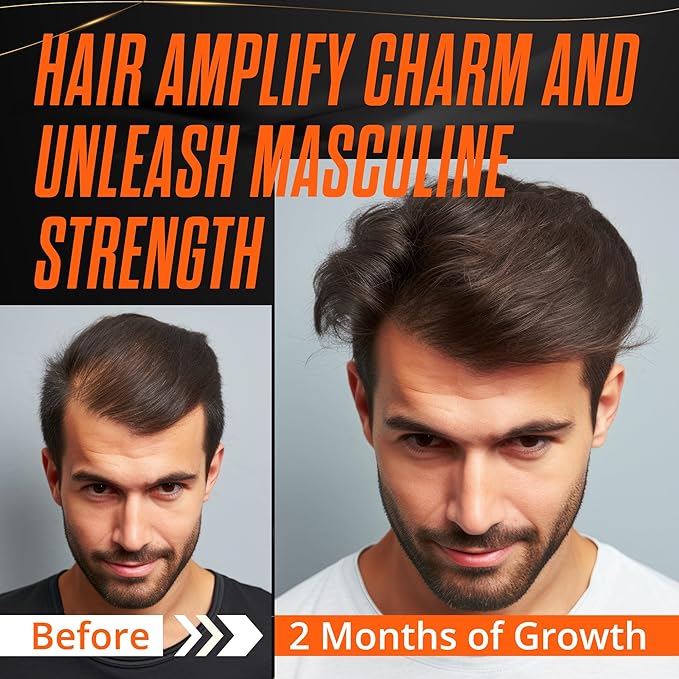 Abera Hair Growth Serum for Hair Loss, Natural Hair Regrowth Treatment for Hair & Beard with Biotin & Castor Oil, Recommended Combo (1 Serum + Gift)