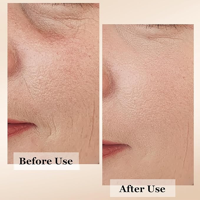 mivida 4-in-1 Anti-Aging Serum for face | Retinol, Vitamin C, Hyaluronic Acid & RoseHip Oil | Reduces Fine Lines, Wrinkles | multi benefit Face Super Serum – 1 Fl Oz