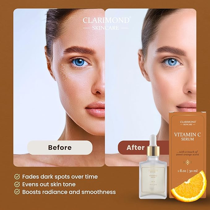 CLARIMOND Vitamin C Serum for Face | 20% Vitamin C | Niacinamide & Hyaluronic Acid | Dark Spot Remover, Brightening & Glow | Chamomile, Witch Hazel & subtle Sweet Orange touch | 1 fl.oz.