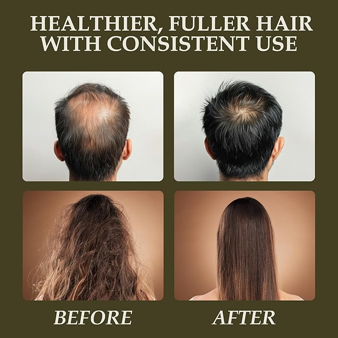 era of nature Batana Oil for Hair Growth - Dr. Sebi Approved, 100% Pure, Raw & Unrefined Oil from Honduras, Nourishes Hair & Scalp, 3.38 Oz