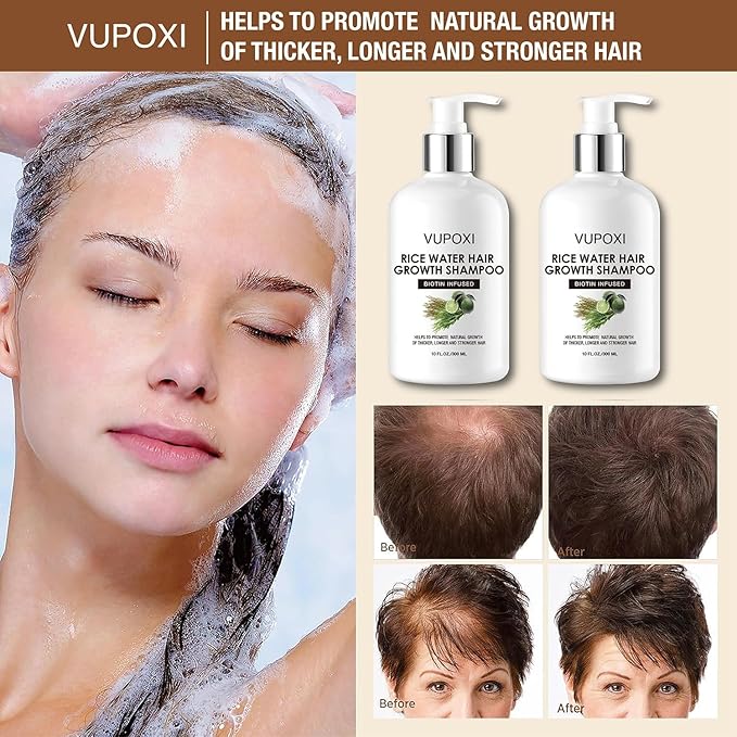 Rice Water Hair Growth Shampoo with Biotin - Ultra-Nourishing Hair Care Set, Promotes Growth, Revitalizes Shine, and Shields from Damage - 10 fl oz