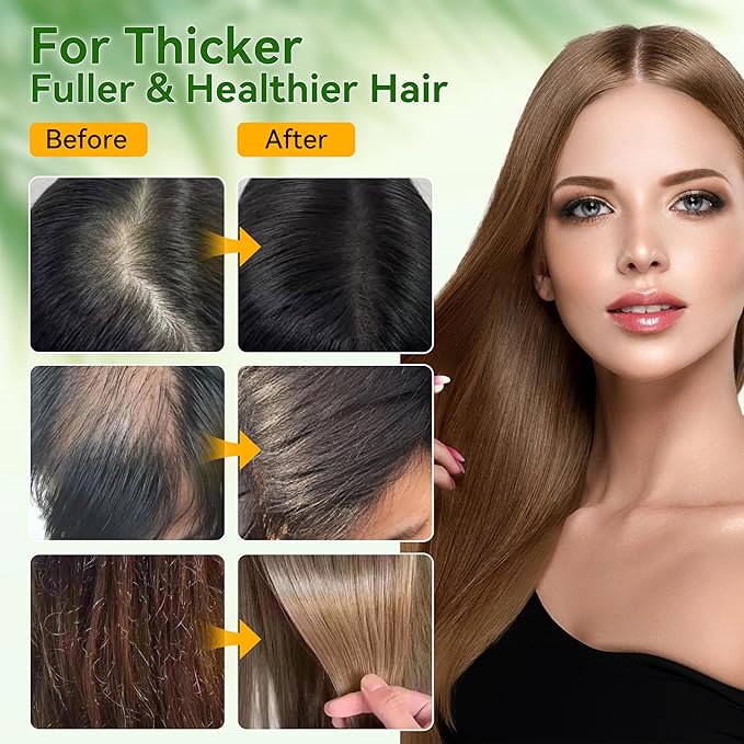 Veakoo Raw Batana Oil for Hair Growth, 100% Natural Pure, Dr. Sebi Organic Batana Oil from Honduras, Unrefined Hair Growth for Women Men, Prevent Hair Loss, Repair Damaged Hair, Nourish Scalp 5.3 oz
