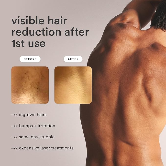 Nood™ Flasher Pro — IPL Laser Hair Removal Device & Anti-Aging Red Light Therapy for Women & Men — Pain-free & Permanent, Visible Results After First Use & Works Everywhere Hair Grows — Gloss White