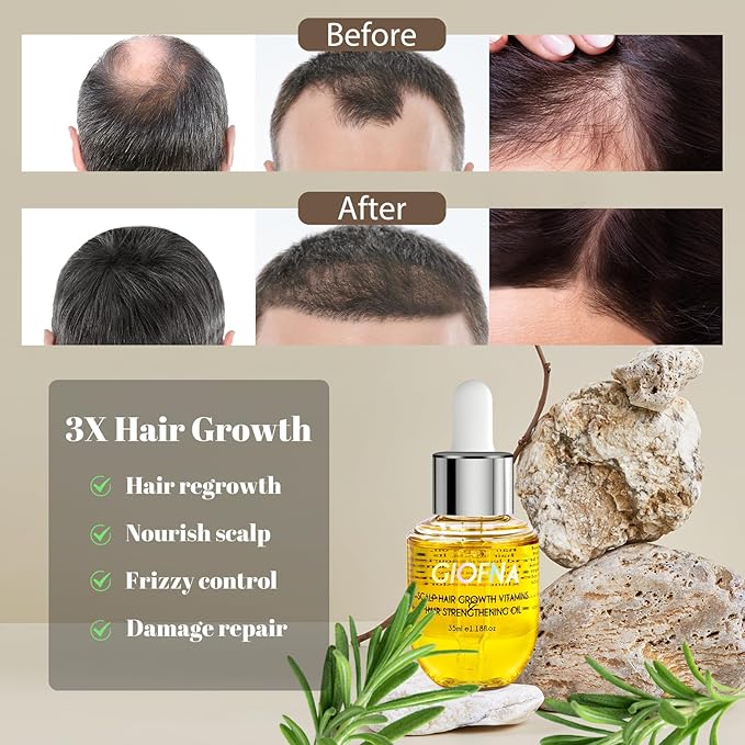 Hair Oil, Rosemary Serum with Bamboo Brush for Frizzy, Damaged Hair Growth Strengthening, Scalp and Argan Care for Women and Men
