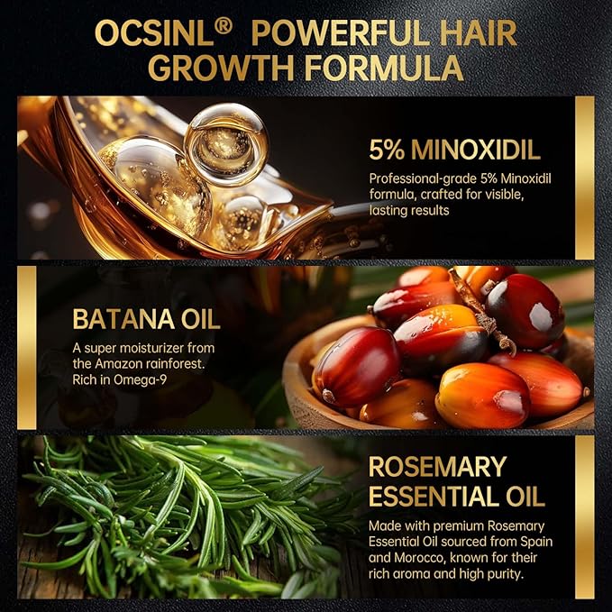 Minoxidil for Men & Women, With Biotin, Batana Oil, Rosemary Essential Oil, Effective Hair Loss Solution, Hair Loss Treatment for Hair Regrowth, Non-Greasy 5% Minoxidil - 60ml