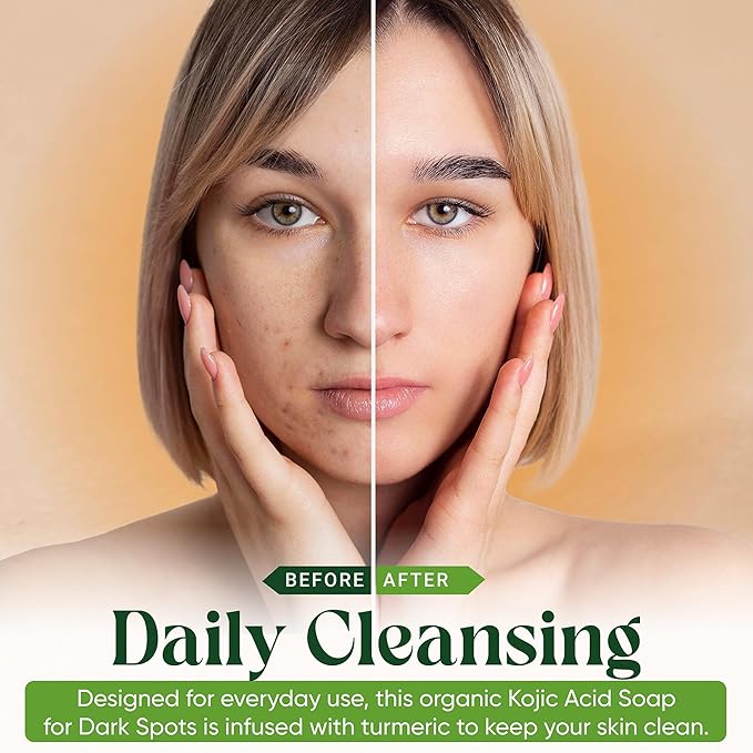 Turmeric Kojic Acid Soap Bars with Vitamin C, Retinol & Hyaluronic Acid – Face & Body Soap with Collagen & Shea Butter – 2-Pack Cleansing Bars for All Skin Types