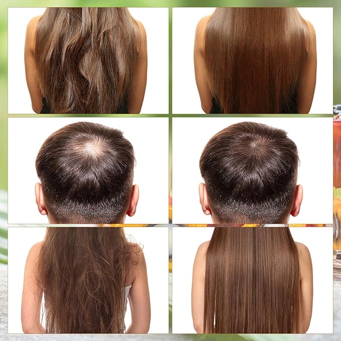 Batana Hair Growth Oil,Batana-Oils,Batana Natural Hair Growth Oils,Organic and Natural Ingredients - Promotes Hair Growthand Thickness for Men & Women