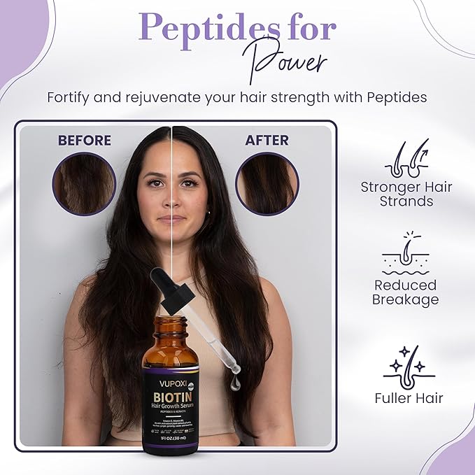 Biotin Hair Growth Serum - Topical Biotin Hair Serum for Hair Growth Infused with Peptides, Keratin, Caffeine, and Vitamins, All Hair Types 1 Fl Oz (1.01 FL OZ, Rosemary)