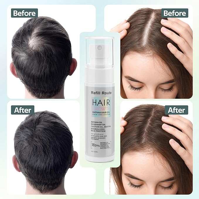 Batana Oil for Hair Growth Spray - Natural Raw Batana Oil Hair Regrowth Treatment for Women/Men with Rice Water, Biotin, Castor, Rosemary for Thicker, Stronger Hair - Vegan Hair Growth Spray