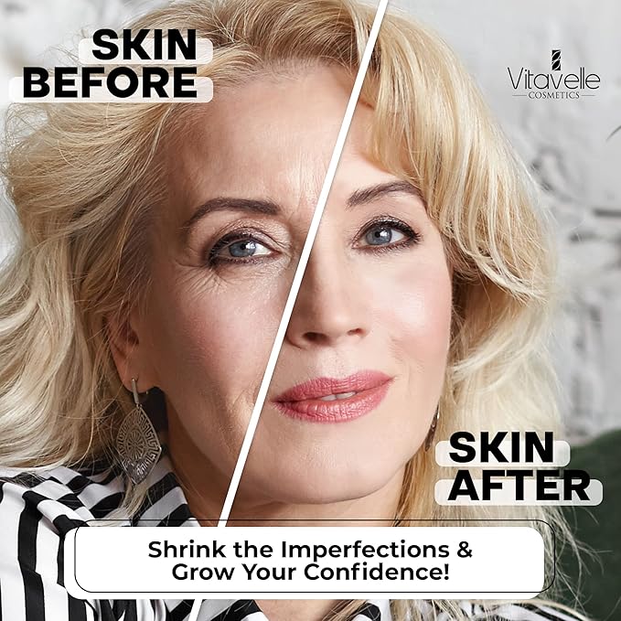 VITAVELLE Niacinamide Cream - Daily Niacinamide Moisturizer for Face - Strengthening Pore Reducer for Face with Plant-Derived Retinol, Shea Butter, & Niacinamide Serum For a Smooth & Even Complexion