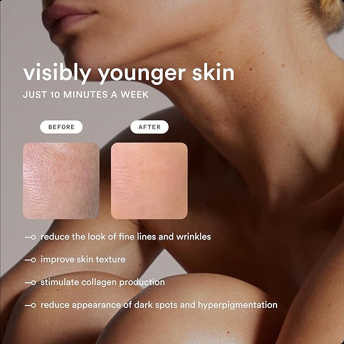 Nood™ Flasher Pro — IPL Laser Hair Removal Device & Anti-Aging Red Light Therapy for Women & Men — Pain-free & Permanent, Visible Results After First Use & Works Everywhere Hair Grows — Gloss White