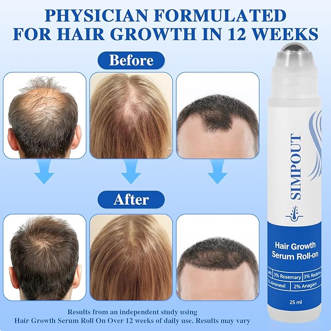 Rosemary Hair Growth Serum Roll On, Nourishing Scalp Hair, Thicker & Stronger Hair, Reduces Hair Fall, Suit for Women Men, For All Hair Types(Rosemary)