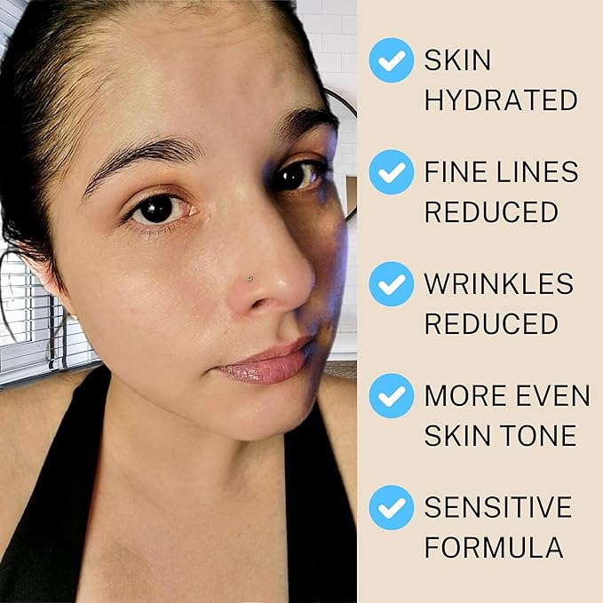 SKIN AURA™ Advanced Anti-Aging Serum - All-In-One Plant Derivative Formula Improves Wrinkles, Fine Lines & Age Spots with 5 Vitamins + Minerals, Hyaluronic Acid & Collagen Peptides - 30ml (1oz)