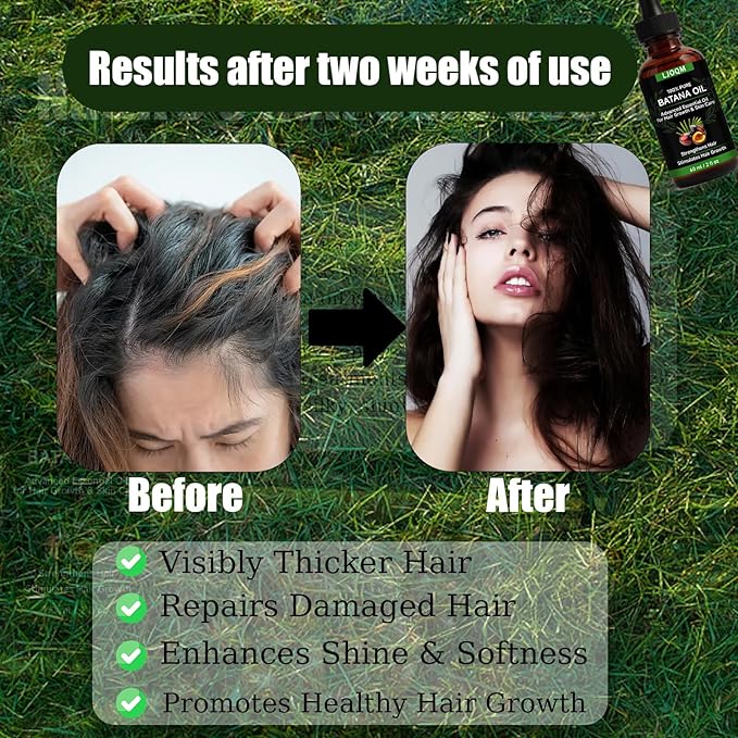 Batana Oil for Hair Growth-100% Organic Batana Oil– Strengthens, Thickens & Restores Natural Hair – Cold Pressed Raw Scalp & Hair Treatment for Men & Women – 60ml