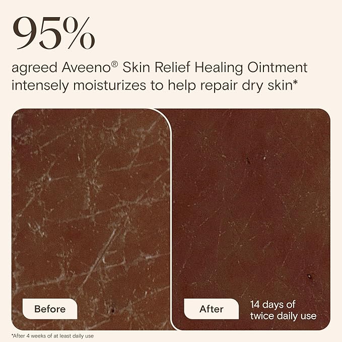 Aveeno Skin Relief Healing Ointment, 72-Hour Skin Protectant with Triple Oat & Shea Butter for Extra Dry, Cracked & Sensitive Skin, Fragrance-Free & Multi-Use for Lips, 7.2 oz