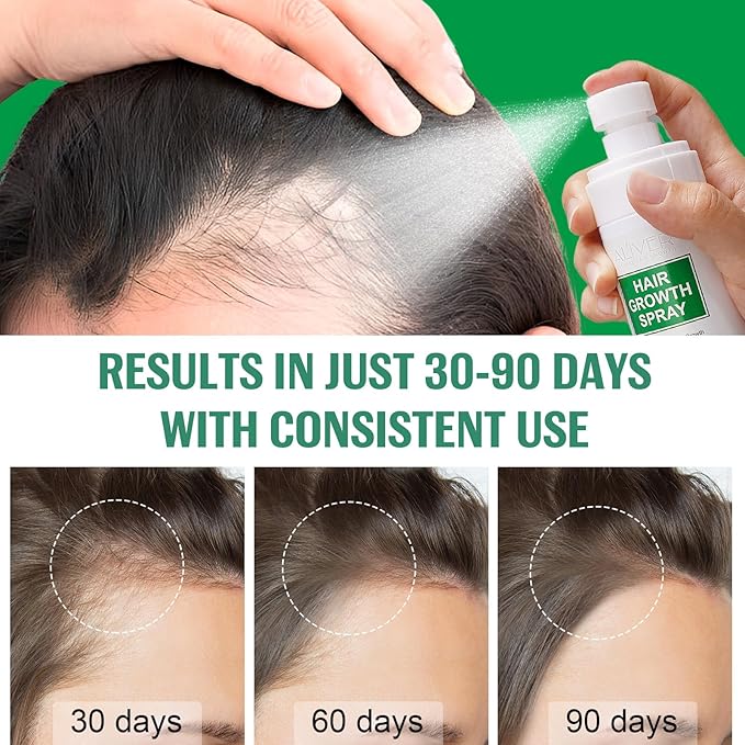 Hair Growth Serum Spray, Natural Hair Growth Spray With Biotin, Batana, Rosemary, and Castor Oil, Caffeine Ginseng Scalp Care Treatment, Thinning Hair Regrowth Thickening for Women Men 4 Fl Oz