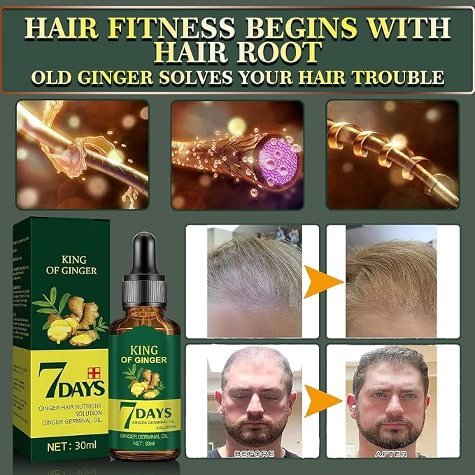 Biotin Hair Growth Serum for Hair Loss Regrowth Treatment for Women & Men, 100% Pure Natural Ginger Essential Oil, 2 Fl Oz / 30ML (2 PCS)