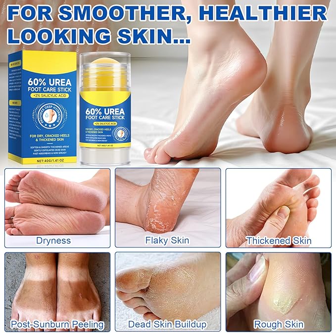 60% Urea Foot Cream, 1.41Fl Oz Foot Cream Maximum Strength Moisturizer for Dry Cracked Heels, Urea Foot Lotion Nourish Cracking Rough Dry Hands/Feet